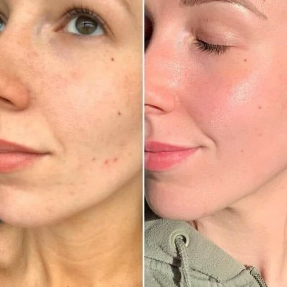 NuSkin ageLOC® LumiSpa® + Normal/Combo/Sensitive/Dry Cleanser (LMK which one) - Picture 7 of 9